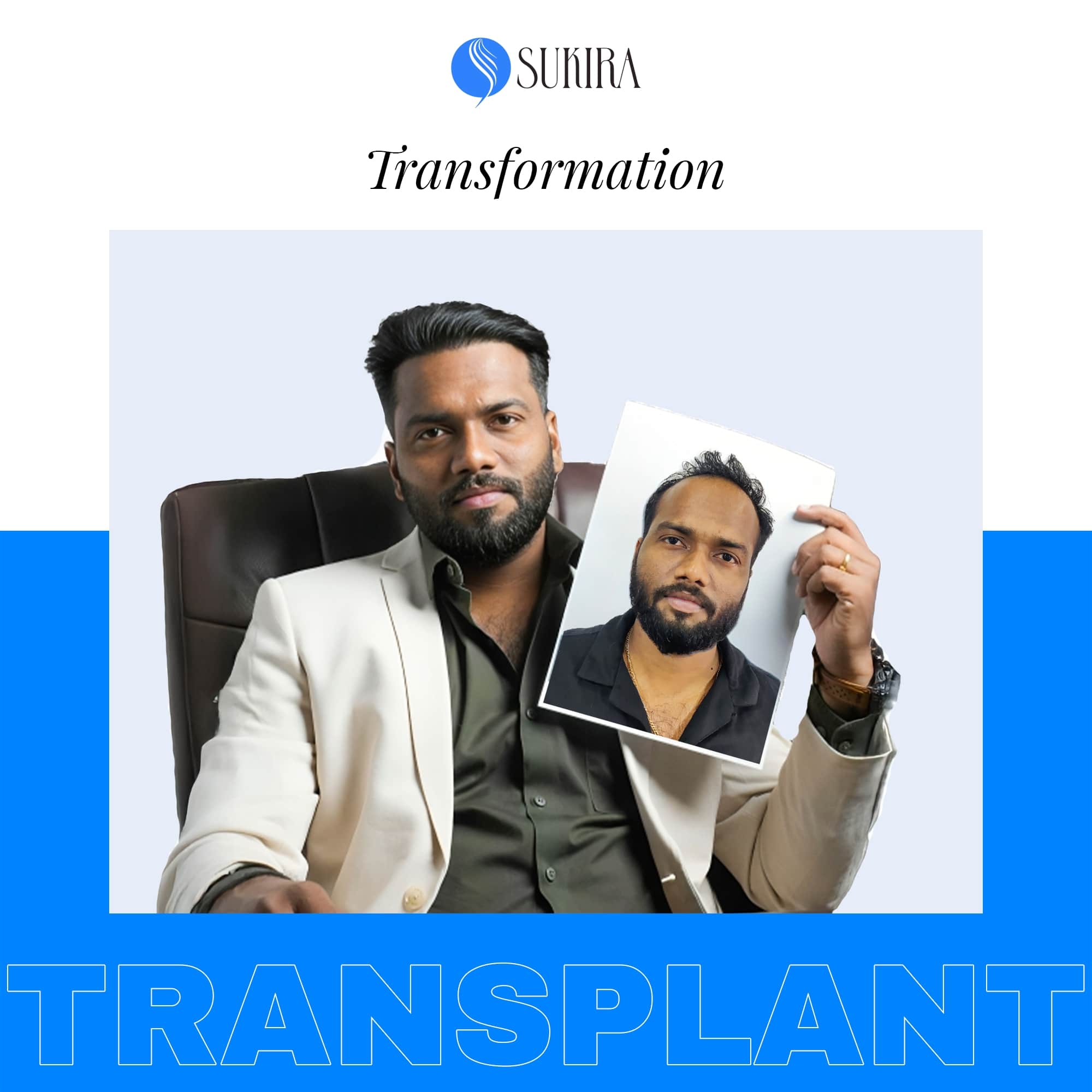 Hair Transplant ba 7